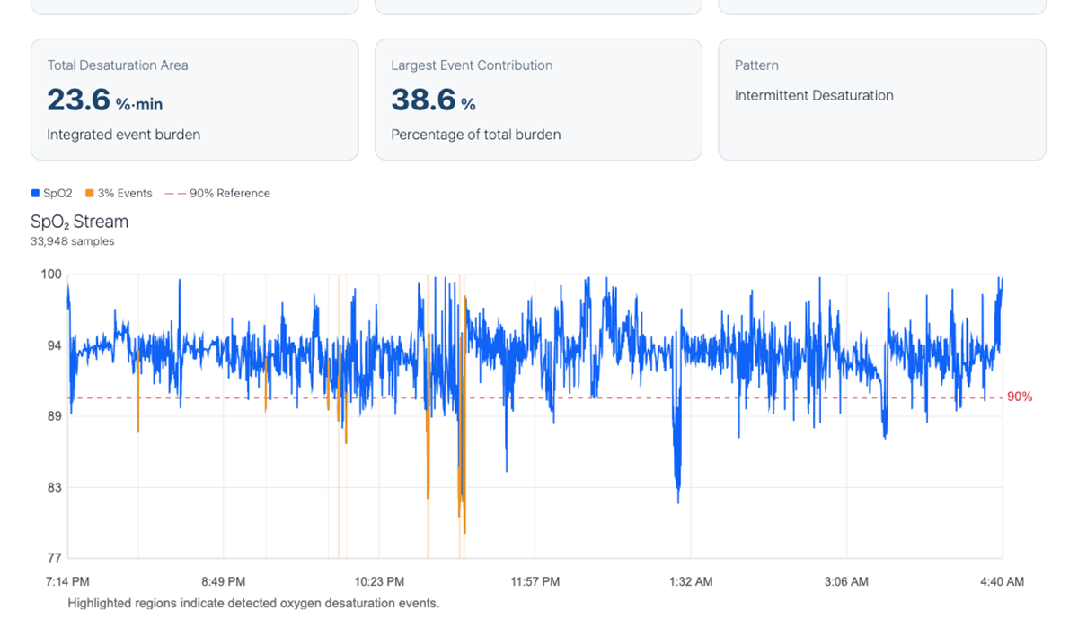 SomnoTrak nightly oxygenation and sleep report