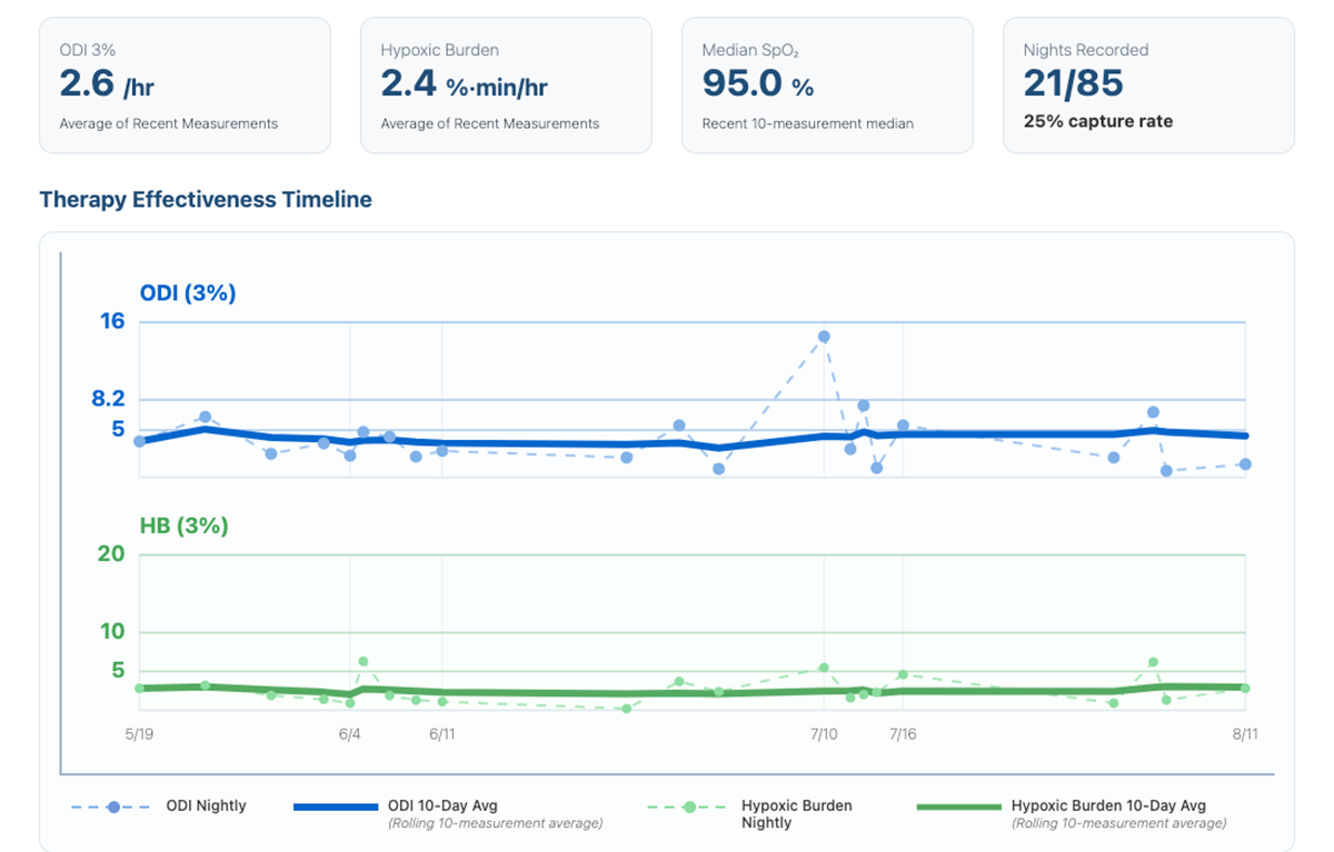 SomnoTrak 90-day trend report